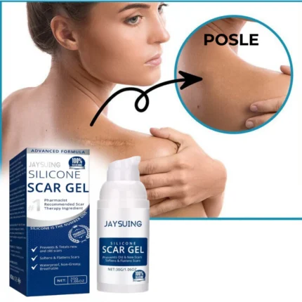 Scar Gel - za uklanjanje ožiljaka